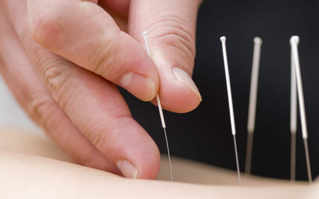 Acupuncture & Surgery