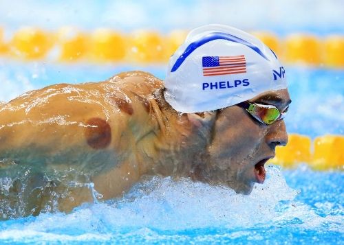 Michael Phelps’ Cupping Habit & Chinese Cupping Therapy Benefits